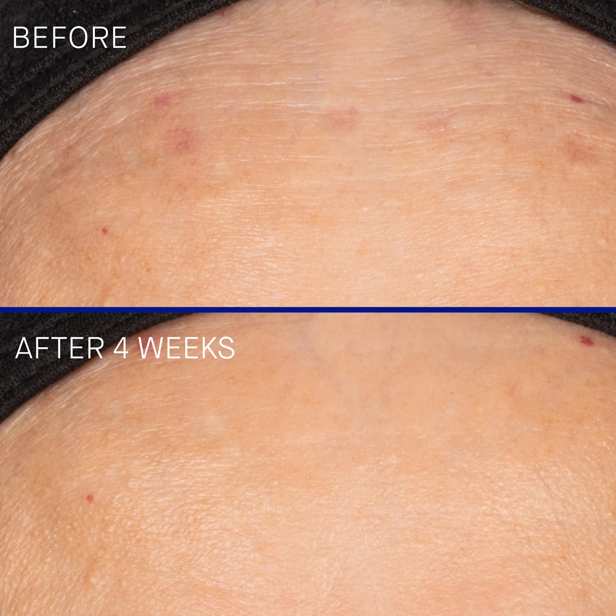 The Vitamin C Serum